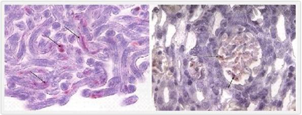 Dirofilaria Immitis y Wolbachia: Implicancias Terapéuticas para la Filariosis Cardiopulmonar - Image 2