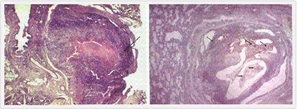 Dirofilaria Immitis y Wolbachia: Implicancias Terapéuticas para la Filariosis Cardiopulmonar - Image 3