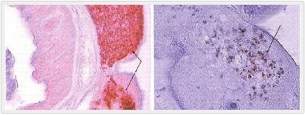 Dirofilaria Immitis y Wolbachia: Implicancias Terapéuticas para la Filariosis Cardiopulmonar - Image 1