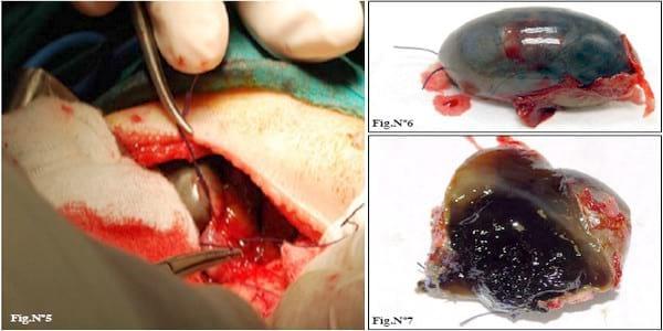 Caso Clínico: Mucocele de vesícula biliar en un perro. - Image 3