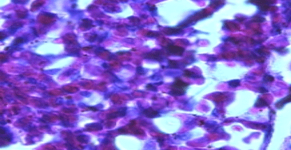 Efecto de un tratamiento con Bromesol y Avlosin sobre el número de macrófagos presentes en el pulmón de pollos parrilleros sanos - Image 8