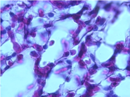 Efecto de un tratamiento con Bromesol y Avlosin sobre el número de macrófagos presentes en el pulmón de pollos parrilleros sanos - Image 7