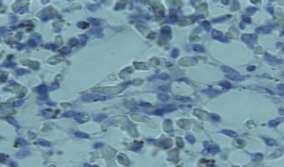 Efecto de un tratamiento con Bromesol y Avlosin sobre el número de macrófagos presentes en el pulmón de pollos parrilleros sanos - Image 11