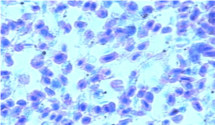 Efecto de un tratamiento con Bromesol y Avlosin sobre el número de macrófagos presentes en el pulmón de pollos parrilleros sanos - Image 3