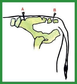 Manual de anestesias y cirugías de bovinos: Sedación, analgesia y anestesia - Image 16