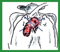 Manual de anestesias y cirugías de bovinos: Cirugías de Abdomen - Image 44