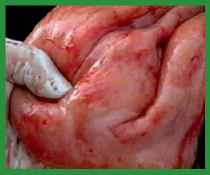 Manual de anestesias y cirugías de bovinos: Cirugías de Abdomen - Image 17