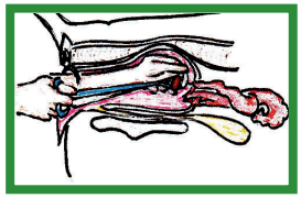 Manual de anestesias y cirugías de bovinos: Cirugías del aparato reproductor de la hembra - Image 44