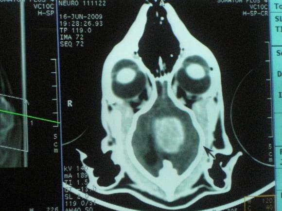 Tomografía cerebral de un gato, corte dorsal, en donde se observa un meningioma del falx cerebral.