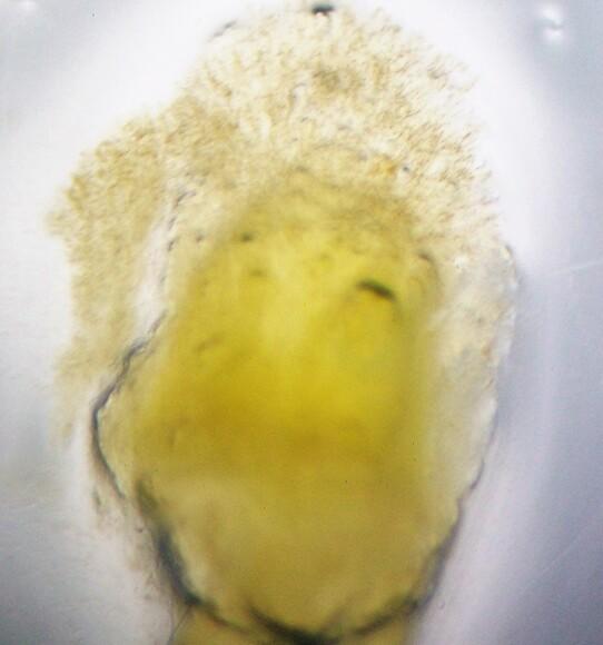 Embrión con hifas del carbón volador de la cebada, Ustilago nuda. Foto Astiz Gasso
