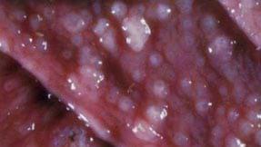 Efectos del parasitismo gastrointestinal sobre la nutrición en vacunos - Image 2