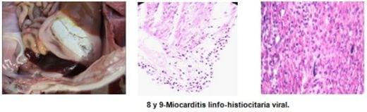 Encefalomiocarditis Viral del Cerdo (EMVC) - Image 3