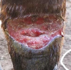 Manejo de tejido de granulación (queloide) en heridas de finasangre de carrera - Image 6
