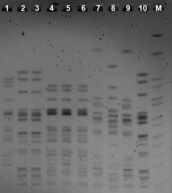 Diseminación en la sala de incubación de clones de escherichia coli: aislamiento a partir de médula ósea y resistencia a gentamicina - Image 2
