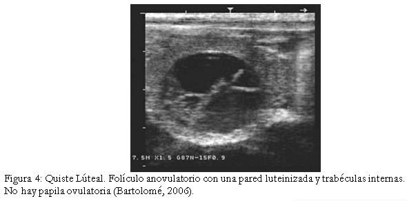 Diagnóstico de anomalías reproductivas vía ecografía en bovinos. - Image 4