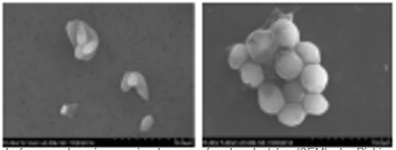 Imágenes de microscopio de escanéo de electrón (SEM) de Pichia guilliermondii (izquierda) y Saccharomyces cerevisiae (derecha). Fotos de ADM Research.