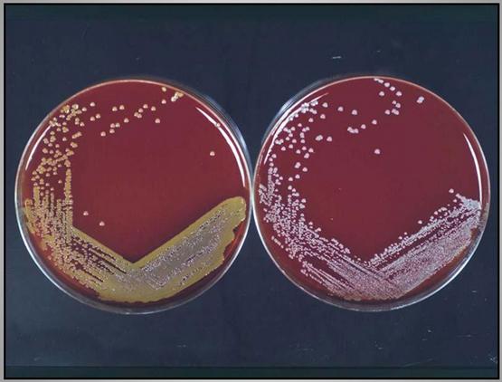 Importancia de los cultivos bacteriológicos en el diagnóstico de la mastitis bovina y antibiograma - Image 9