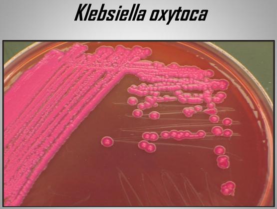 Importancia de los cultivos bacteriológicos en el diagnóstico de la mastitis bovina y antibiograma - Image 14