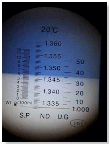 Refractómetro clínico: medición