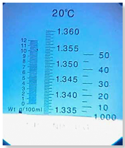 Refractómetro clínico: calibración