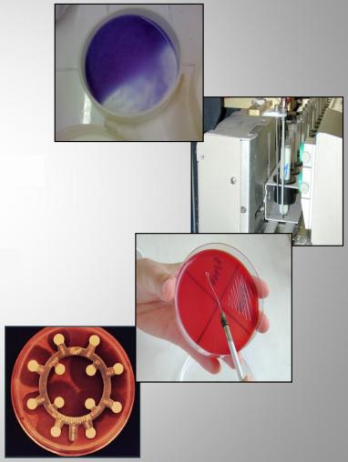 Importancia de los cultivos bacteriológicos en el diagnóstico de la mastitis bovina y antibiograma - Image 5