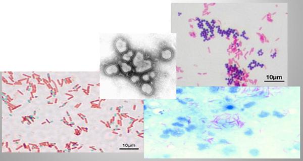 Importancia de los cultivos bacteriológicos en el diagnóstico de la mastitis bovina y antibiograma - Image 16