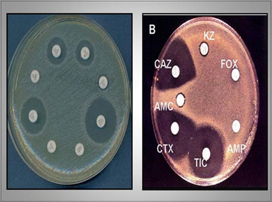 Importancia de los cultivos bacteriológicos en el diagnóstico de la mastitis bovina y antibiograma - Image 19