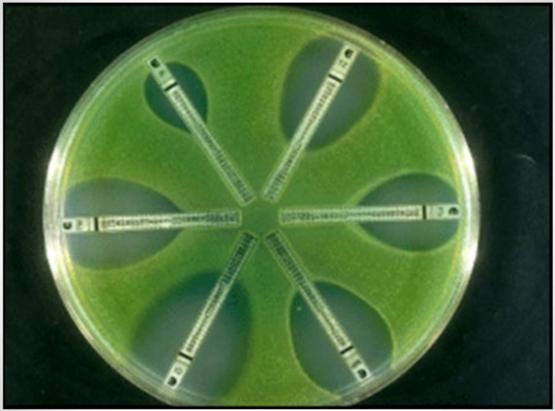 Importancia de los cultivos bacteriológicos en el diagnóstico de la mastitis bovina y antibiograma - Image 21