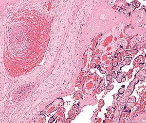 Caso de estudio: patología e histopatología como herramientas para el diagnóstico de trastornos reproductivos en cerdos relacionados con micotoxinas - Image 9